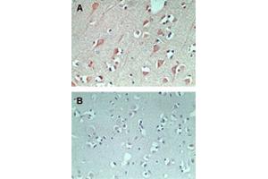 IHC staining of FAM3C using FAM3C polyclonal antibody  in normal human brain at 5 ug/mL (using control rabbit Ig for figure B). (FAM3C anticorps  (AA 40-80))