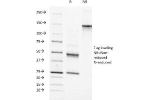 SDS-PAGE Analysis Purified Moesin Mouse Monoclonal Antibody (MSN/491).