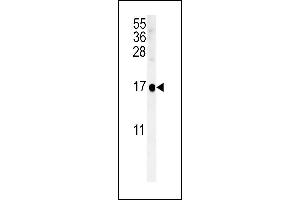 SIKE Antibody (C-term) (ABIN651568 and ABIN2840305) western blot analysis in NCI- cell line lysates (35 μg/lane). (SIKE1 anticorps  (C-Term))