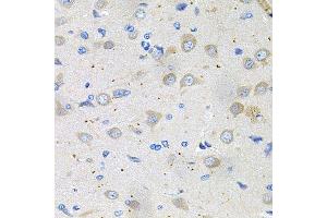 Immunohistochemistry of paraffin-embedded rat brain using GNE antibody (ABIN5996449) at dilution of 1/100 (40x lens). (GNE anticorps)