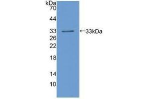 Detection of Recombinant LIPD, Human using Polyclonal Antibody to Lipoprotein lipase (LPL) (Lipoprotein Lipase anticorps  (AA 55-316))
