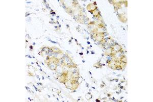 Immunohistochemistry of paraffin-embedded human stomach using IFNL3 antibody at dilution of 1:100 (40x lens). (IL28B anticorps)