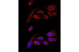 Confocal immunofluorescence analysis of U2OS cells using H Polyclonal Antibody (ABIN6131125, ABIN6137333, ABIN6137334 and ABIN6220624) at dilution of 1:100. (ATP5H anticorps  (AA 1-161))