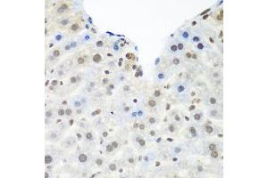 Immunohistochemistry of paraffin-embedded mouse liver using TARDBP antibody at dilution of 1:100 (40x lens). (TARDBP anticorps)