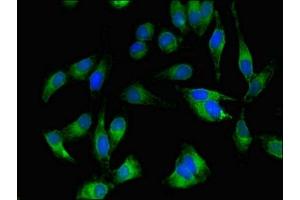 Immunofluorescent analysis of Hela cells using ABIN7174011 at dilution of 1:100 and Alexa Fluor 488-congugated AffiniPure Goat Anti-Rabbit IgG(H+L)