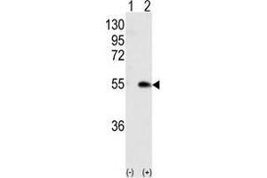 Western blot analysis of CAMK1G (arrow) using rabbit polyclonal CAMK1G (Center) Antibody . (CAMK1G anticorps  (Center))