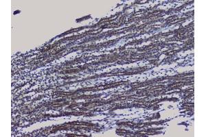IHC analysis of NRF1 using anti-NRF1 antibody (ABIN6719347).