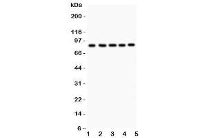 Western blot testing of FOXM1 antibody and Lane 1:  HeLa (FOXM1 anticorps  (AA 411-763))