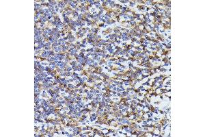 Immunohistochemistry of paraffin-embedded human tonsil using ASC/TMS1 Rabbit pAb (ABIN7269756) at dilution of 1:200 (40x lens).