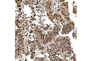 IHC analysis of TIF1 gamma/TRIM33 using anti TIF1 gamma/TRIM33 antibody (ABIN7599621). (TRIM33 anticorps  (AA 1001-1127))