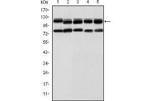 Western blot analysis using BMPR2 mouse mAb against Hela (1), A431 (2), NIH/3T3 (3), Cos7 (4) and PC-12 (5) cell lysate. (BMPR2 anticorps)