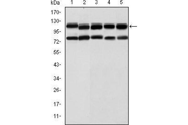 BMPR2 anticorps