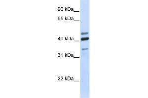 WB Suggested Anti-HYAL1 Antibody Titration:  0. (HYAL1 anticorps  (N-Term))