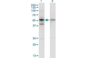 Western Blot analysis of SERPINB1 expression in transfected 293T cell line by SERPINB1 monoclonal antibody (M02), clone 4D7. (SERPINB1 anticorps  (AA 201-300))