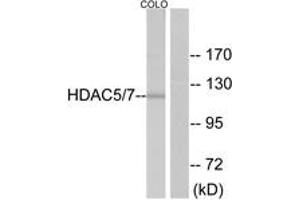 Western blot analysis of extracts from NIH-3T3 cells, using HDAC5 (Ab-498) Antibody. (HDAC5 anticorps  (AA 464-513))