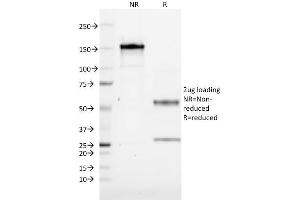 SDS-PAGE Analysis Purified CD19 Mouse Monoclonal Antibody (CVID3/155).