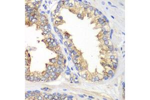 Immunohistochemistry of paraffin-embedded human prostate using KLK10 antibody at dilution of 1:100 (40x lens). (Kallikrein 10 anticorps)