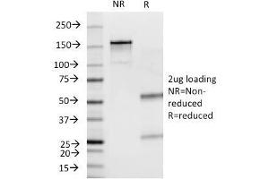 SDS-PAGE Analysis Purified Insulin Mouse Monoclonal Antibody (E2-E3).