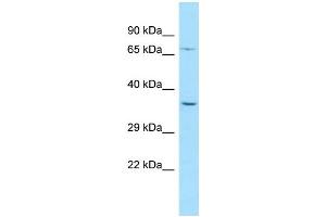 WB Suggested Anti-PALMD Antibody Titration: 1. (PALMD anticorps  (N-Term))