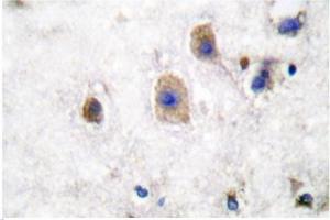 Image no. 2 for anti-Ephrin B3 (EFNB3) antibody (ABIN265403) (Ephrin B3 anticorps)