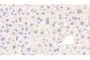 Detection of CTH in Mouse Liver Tissue using Polyclonal Antibody to Cystathionine (CTH)