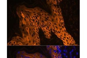 Immunofluorescence analysis of Human skin using KRT14 Polyclonal Antibody at dilution of 1:100.