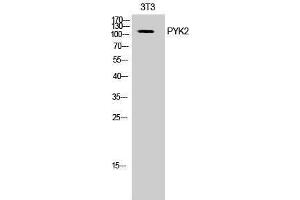 Western Blotting (WB) image for anti-PTK2B Protein tyrosine Kinase 2 beta (PTK2B) (Ser374) antibody (ABIN6285192)