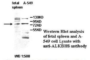 Image no. 1 for anti-Platelet-Derived Growth Factor CC (PDGFCC) antibody (ABIN790864) (Platelet-Derived Growth Factor CC (PDGFCC) anticorps)