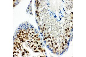 Anti- MCAK antibody, IHC(P) IHC(P): Mouse Testis Tissue