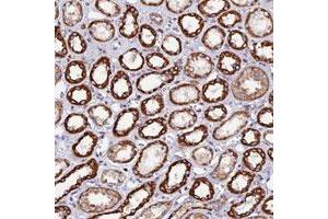 Immunohistochemical staining of human kidney with C19orf40 polyclonal antibody  shows strong cytoplasmic positivity in renal tubules. (C19orf24 anticorps)