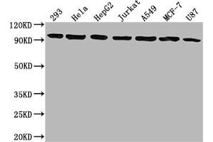 Western Blot Positive WB detected in: 293 whole cell lysate, Hela whole cell lysate, HepG2 whole cell lysate, Jurkat whole cell lysate, A549 whole cell lysate, MCF-7 whole cell lysate, U87 whole cell lysate All lanes: NR3C1 antibody at 1:1500 Secondary Goat polyclonal to rabbit IgG at 1/50000 dilution Predicted band size: 86, 83, 82, 77, 76, 65, 61, 52, 51, 50 kDa Observed band size: 95 kDa