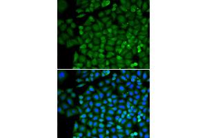 Immunofluorescence analysis of HeLa cells using SELENBP1 antibody (ABIN5970564). (SELENBP1 anticorps)