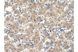 PPIB antibody was used for immunohistochemistry at a concentration of 4-8 ug/ml to stain Hepatocytes (arrows) in Human Liver.