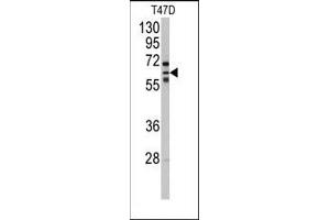 Image no. 1 for anti-Cytochrome P450, Family 2, Subfamily C, Polypeptide 8 (CYP2C8) (N-Term) antibody (ABIN360416) (CYP2C8 anticorps  (N-Term))