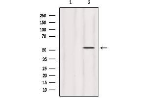 Western blot analysis of extracts from HepG2, using HERP Antibody.