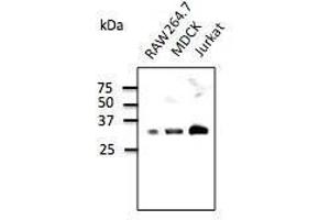 Anti-Rab35 Ab at 1/500 dilution, 293HEK transfected With GFP-Rab35, tysates at 100 µg per Iane, rabbit polyclonal to goat lµg (HRP) at 1/10,000 dilution,