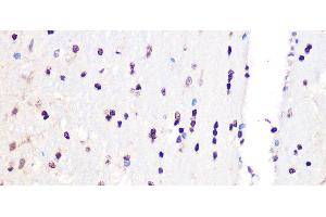 Immunohistochemistry of paraffin-embedded Rat brain using PCIF1 Polyclonal Antibody at dilution of 1:100 (40x lens). (PCIF1 anticorps)