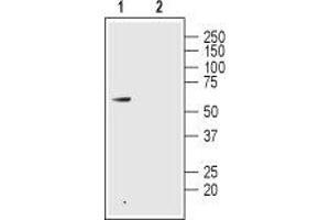 Western blot analysis of rat colon lysate: - 1. (GLP2R anticorps  (1st Extracellular Loop))