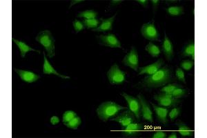 Immunofluorescence of monoclonal antibody to IRAK1 on HeLa cell.
