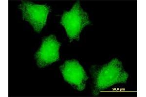 Immunofluorescence of monoclonal antibody to CAMK2A on HeLa cell.