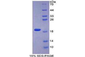 SDS-PAGE analysis of Mouse COL2A1 Protein. (COL2A1 Protéine)