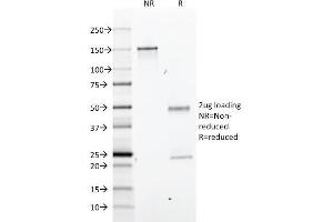 SDS-PAGE Analysis Purified GFAP Mouse Monoclonal Antibody (GA-5).