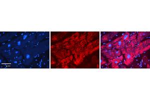 Rabbit Anti-AGPAT2 Antibody Catalog Number: ARP44636_P050 Formalin Fixed Paraffin Embedded Tissue: Human heart Tissue Observed Staining: Cytoplasmic Primary Antibody Concentration: N/A Other Working Concentrations: 1:600 Secondary Antibody: Donkey anti-Rabbit-Cy3 Secondary Antibody Concentration: 1:200 Magnification: 20X Exposure Time: 0. (AGPAT2 anticorps  (C-Term))