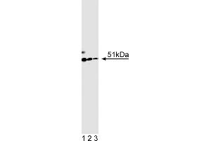 Western Blotting (WB) image for anti-HNF1 Homeobox B (HNF1B) (AA 1-101) antibody (ABIN968855) (HNF1B anticorps  (AA 1-101))