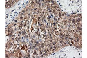 Image no. 9 for anti-Destrin (Actin Depolymerizing Factor) (DSTN) antibody (ABIN1497907)