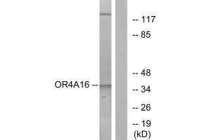 Western blot analysis of extracts from COLO cells, using OR4A16 antibody. (OR4A16 anticorps  (C-Term))