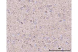 IHC analysis of PTN using anti-PTN antibody (ABIN7602164). (Pleiotrophin anticorps  (AA 61-148))