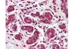 Image no. 1 for anti-Thyroid Hormone Receptor, beta (THRB) (AA 1-169) antibody (ABIN467595)