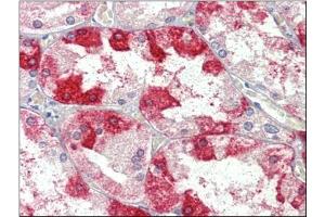 Kidney, Human: Formalin-Fixed, Paraffin-Embedded (FFPE) (Clathrin Heavy Chain (CLTC) (Heavy Chain) anticorps)