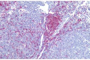 Immunohistochemistry staining of human tonsil (paraffin-embedded sections) with anti-CD5 (L17F12), 10 μg/mL.